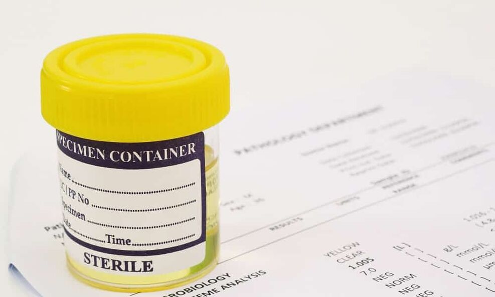 Pirms antibiotiku lietošanas jums jāveic urīna analīze